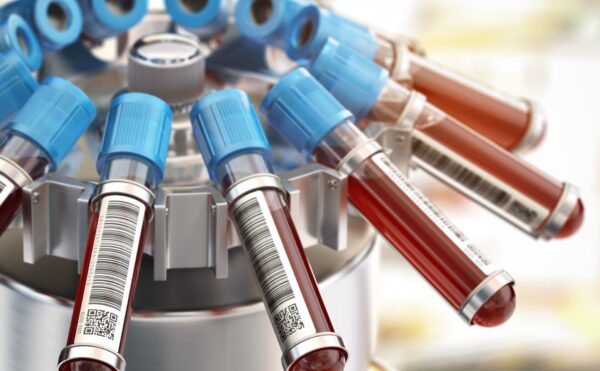 Blood test tubes in centrifuge. Medical laboratory concept.