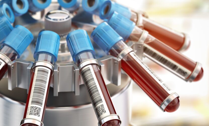 Blood test tubes in centrifuge. Medical laboratory concept.