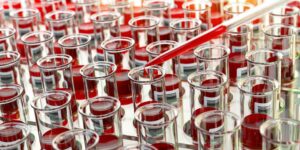 Open blood test tubes in laboratory.