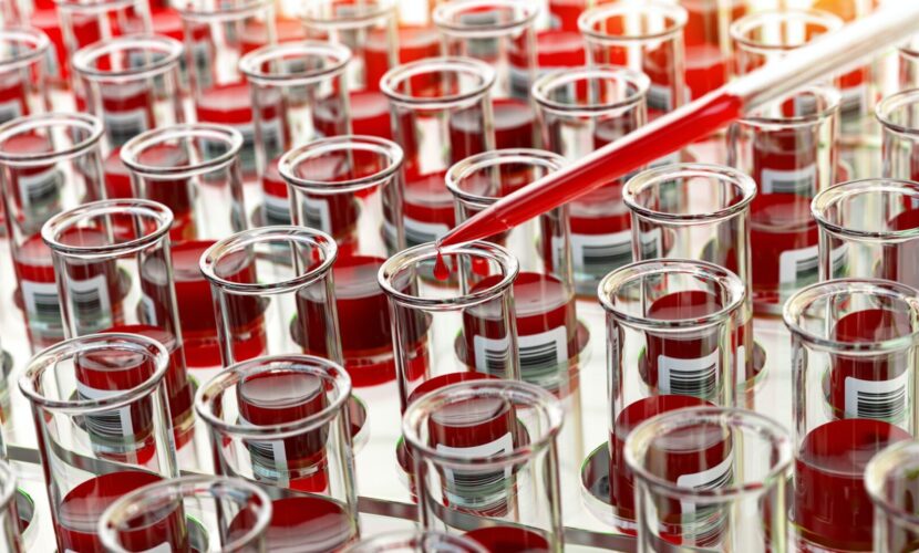 Open blood test tubes in laboratory.