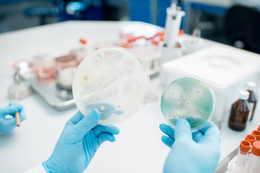 Bacteria with antibiotics in Petri dishes